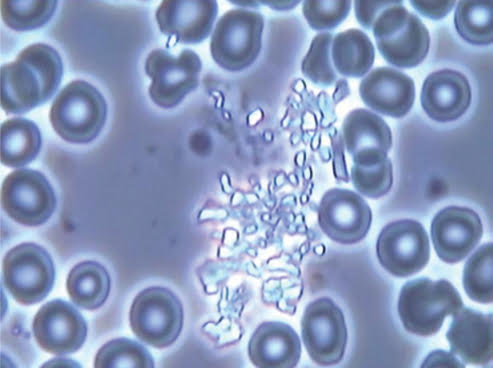 live blood analysis