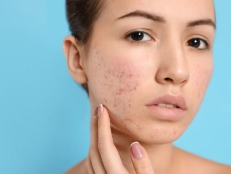 skin-issues-antibiotics-and-roaccutane